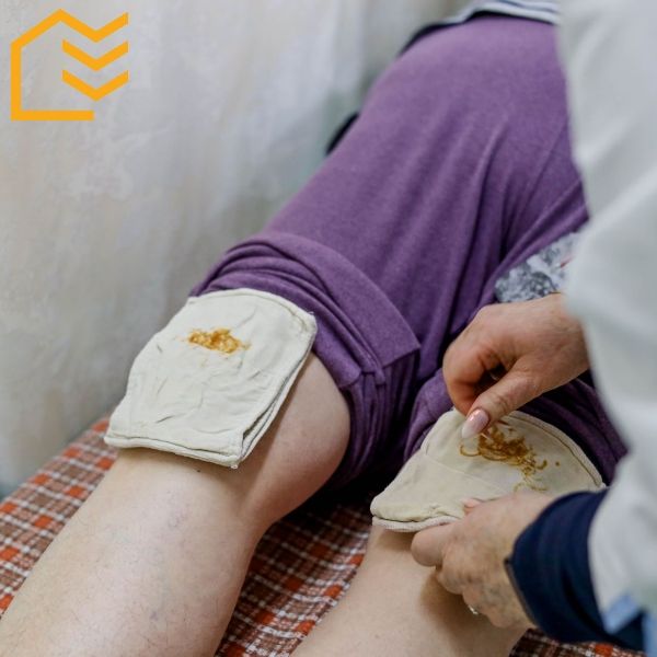 Грязевая аппликация